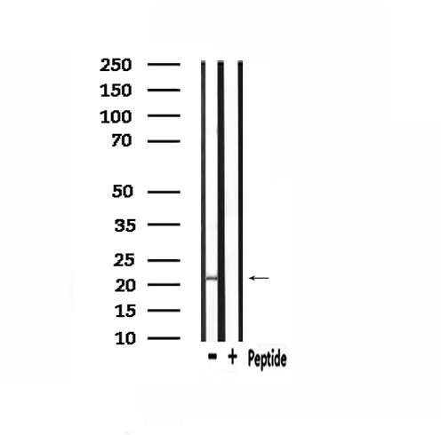 PMP22 Antibody - Western blot analysis of extracts of HepG2 cells using GAS3 antibody.