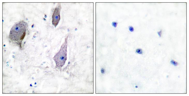 PMP22 Antibody - Peptide - + Immunohistochemical analysis of paraffin-embedded human brain tissue using PMP22 antibody.