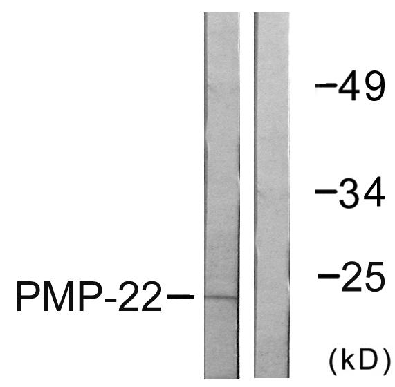 PMP22 Antibody - Western blot analysis of extracts from MDA-MB-435 cells, using PMP22 antibody.