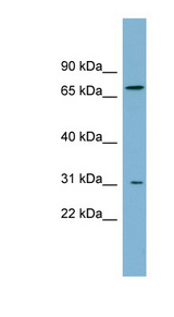 PMP70 Antibody - ABCD3 / PMP70 antibody Western blot of Fetal Small Intestine lysate. This image was taken for the unconjugated form of this product. Other forms have not been tested.