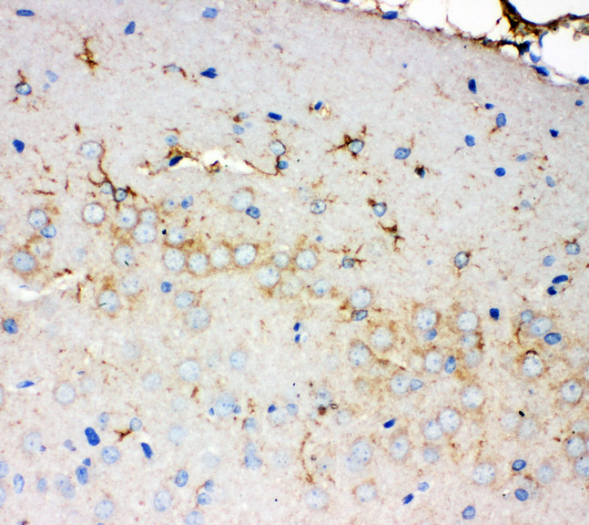 PMP70 Antibody - PMP70 antibody. IHC(P): Rat Brain Tissue.
