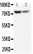 PMP70 Antibody - Anti-PMP70 antibody, Western blotting Lane 1: Rat Lung Tissue LysateLane 2: Rat Ovary Tissue Lysate