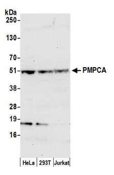 PMPCA Antibody - Detection of human PMPCA by western blot. Samples: Whole cell lysate (50 µg) from HeLa, HEK293T, and Jurkat cells prepared using NETN lysis buffer. Antibody: Affinity purified rabbit anti-PMPCA antibody used for WB at 0.1 µg/ml. Detection: Chemiluminescence with an exposure time of 30 seconds.