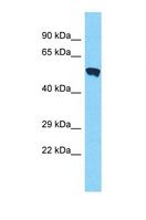 PMPCA Antibody - Western blot of Human MCF7. PMPCA antibody dilution 1.0 ug/ml.  This image was taken for the unconjugated form of this product. Other forms have not been tested.