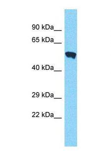PMPCA Antibody - Western blot of Human MCF7. PMPCA antibody dilution 1.0 ug/ml.  This image was taken for the unconjugated form of this product. Other forms have not been tested.
