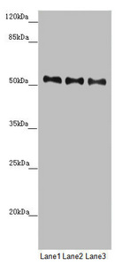 PMPCB / MPP11 Antibody - Western blot All Lanes:PMPCB antibody at 0.69 ug/ml Lane 1: Mouse heart tissue Lane 2: Mouse kidney tissue Lane 3: Mouse liver tissue Secondary Goat polyclonal to rabbit IgG at 1/10000 dilution Predicted band size: 54 kDa Observed band size: 54 kDa