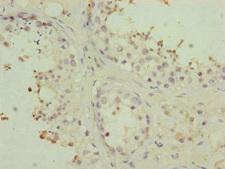 PMPCB / MPP11 Antibody - Immunohistochemistry of paraffin-embedded human testis tissue at dilution of 1:100
