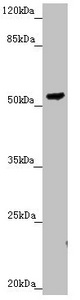 PMPCB / MPP11 Antibody - Western blot All Lanes:PMPCB antibody at 2.3 ug/ml+ HepG-2 whole cell lysate Secondary Goat polyclonal to rabbit IgG at 1/10000 dilution Predicted band size: 54 kDa Observed band size: 54 kDa