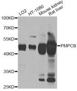 PMPCB / MPP11 Antibody - Western blot analysis of extracts of various cell lines, using PMPCB antibody at 1:1000 dilution. The secondary antibody used was an HRP Goat Anti-Rabbit IgG (H+L) at 1:10000 dilution. Lysates were loaded 25ug per lane and 3% nonfat dry milk in TBST was used for blocking. An ECL Kit was used for detection and the exposure time was 5s.