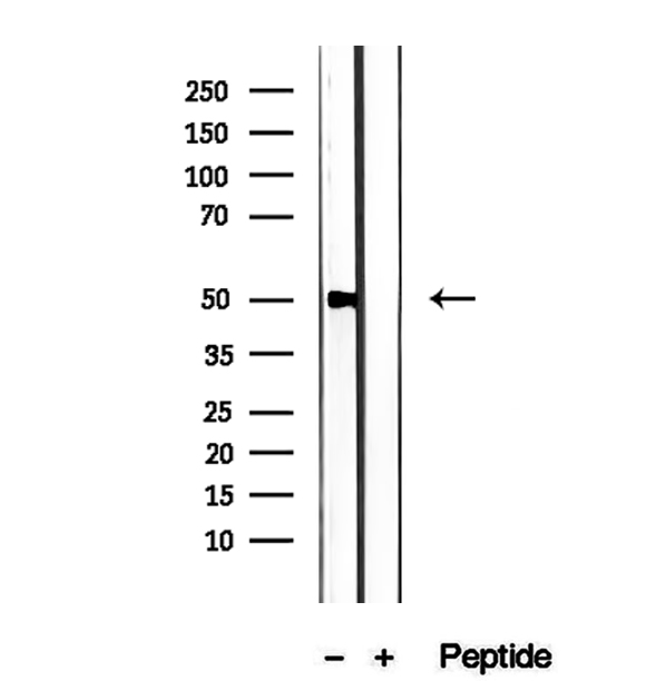PMPCB / MPP11 Antibody - Western blot analysis of extracts of rat liver tissue using PMPCB antibody.