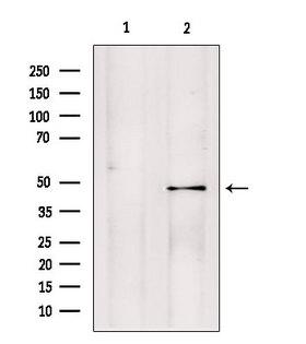PMPCB / MPP11 Antibody - Western blot analysis of extracts of rat brain tissue using PMPCB antibody. Lane 1 was treated with the blocking peptide.