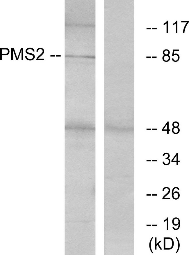 PMS2 Antibody - Western blot analysis of lysates from HeLa cells, using PMS2 Antibody. The lane on the right is blocked with the synthesized peptide.