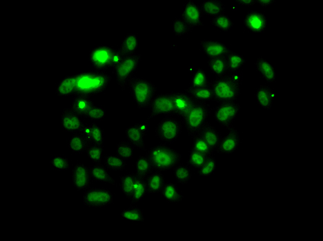PMS2 Antibody - Immunofluorescence analysis of U2OS cells using PMS2 antibody.