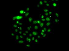 PMS2 Antibody - Immunofluorescence analysis of U2OS cells using PMS2 antibody.