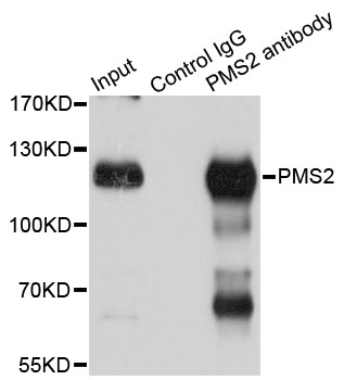 PMS2 Antibody - Immunoprecipitation analysis of 150ug extracts of Jurkat cells using 3ug PMS2 antibody. Western blot was performed from the immunoprecipitate using PMS2 antibody at a dilition of 1:500.