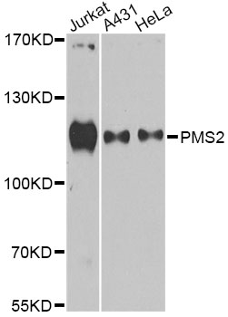 PMS2 Antibody - Western blot analysis of extracts of various cell lines, using PMS2 antibody at 1:1000 dilution. The secondary antibody used was an HRP Goat Anti-Rabbit IgG (H+L) at 1:10000 dilution. Lysates were loaded 25ug per lane and 3% nonfat dry milk in TBST was used for blocking. An ECL Kit was used for detection and the exposure time was 90s.