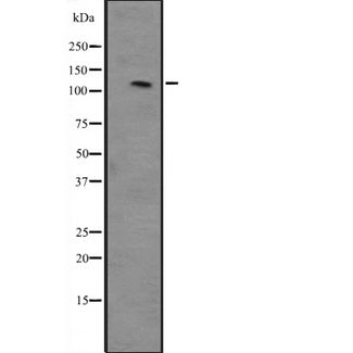 PMS2 Antibody - Western blot analysis of PMS2 expression in HeLa cells lysate. The lane on the left is treated with the antigen-specific peptide.