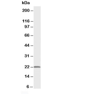 PMVK Antibody - Western blot testing of PMVK antibody and rat heart tissue lysate