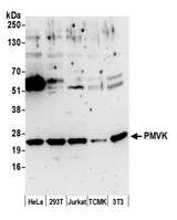 PMVK Antibody - Detection of human and mouse PMVK by western blot. Samples: Whole cell lysate (50 µg) from HeLa, HEK293T, Jurkat, mouse TCMK-1, and mouse NIH 3T3 cells prepared using NETN lysis buffer. Antibody: Affinity purified rabbit anti-PMVK antibody used for WB at 1:1000. Detection: Chemiluminescence with an exposure time of 3 seconds.