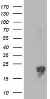 PMVK Antibody - HEK293T cells were transfected with the pCMV6-ENTRY control (Left lane) or pCMV6-ENTRY PMVK (Right lane) cDNA for 48 hrs and lysed. Equivalent amounts of cell lysates (5 ug per lane) were separated by SDS-PAGE and immunoblotted with anti-PMVK.