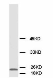 PMVK Antibody -  This image was taken for the unconjugated form of this product. Other forms have not been tested.
