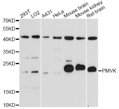 PMVK Antibody - Western blot analysis of extracts of various cell lines, using PMVK antibody at 1:3000 dilution. The secondary antibody used was an HRP Goat Anti-Rabbit IgG (H+L) at 1:10000 dilution. Lysates were loaded 25ug per lane and 3% nonfat dry milk in TBST was used for blocking. An ECL Kit was used for detection and the exposure time was 90s.
