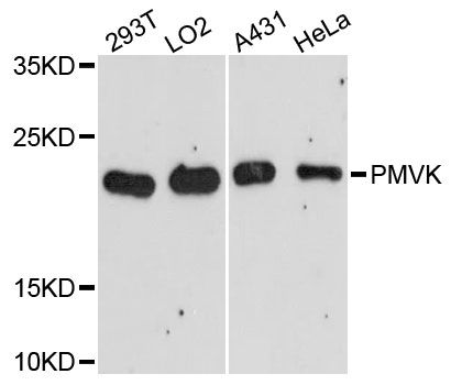 PMVK Antibody - Western blot analysis of extracts of various cell lines, using PMVK antibody at 1:3000 dilution. The secondary antibody used was an HRP Goat Anti-Rabbit IgG (H+L) at 1:10000 dilution. Lysates were loaded 25ug per lane and 3% nonfat dry milk in TBST was used for blocking. An ECL Kit was used for detection and the exposure time was 90s.