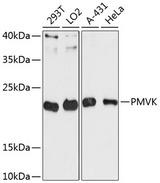 PMVK Antibody - Western blot analysis of extracts of various cell lines using PMVK Polyclonal Antibody at dilution of 1:3000.