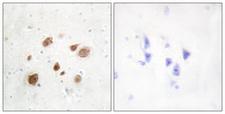 PNCK / CaMK1b Antibody - Immunohistochemistry analysis of paraffin-embedded human brain tissue, using CaMK1-beta Antibody. The picture on the right is blocked with the synthesized peptide.