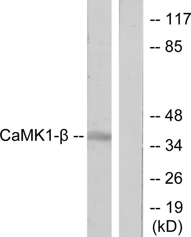 PNCK / CaMK1b Antibody - Western blot analysis of lysates from LOVO cells, treated with H2O2 100uM 30', using CaMK1-beta Antibody. The lane on the right is blocked with the synthesized peptide.