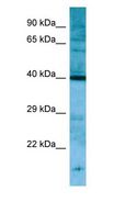 PNCK / CaMK1b Antibody - PNCK antibody Western Blot of Rat Stomach.  This image was taken for the unconjugated form of this product. Other forms have not been tested.
