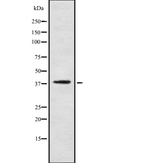 PNCK / CaMK1b Antibody - Western blot analysis of CaMKIbeta using LOVO cells whole cells lysates
