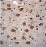 PNKD Antibody - PNKD Antibody immunohistochemistry of formalin-fixed and paraffin-embedded human brain tissue followed by peroxidase-conjugated secondary antibody and DAB staining.