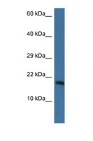 PNKD Antibody - PNKD antibody Western blot of Mouse Heart lysate. Antibody concentration 1 ug/ml. This image was taken for the unconjugated form of this product. Other forms have not been tested.
