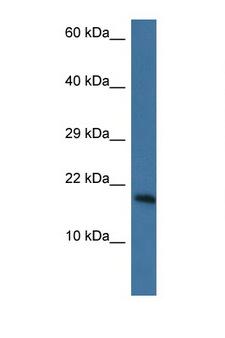 PNKD Antibody - PNKD antibody Western blot of Mouse Heart lysate. Antibody concentration 1 ug/ml. This image was taken for the unconjugated form of this product. Other forms have not been tested.