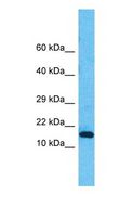 PNKD Antibody - Western blot of PNKD Antibody with human HepG2 Whole Cell lysate.  This image was taken for the unconjugated form of this product. Other forms have not been tested.