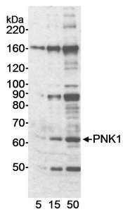 PNKP Antibody - Detection of Human PNK1 by Western Blot. Samples: Whole cell lysate (5, 15 and 50 ug) from HeLa cells. Antibody: Affinity purified rabbit anti-PNK1 antibody used at 0.4 ug/ml. Detection: Chemiluminescence with an exposure time of 20 seconds.