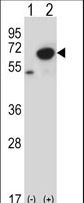 PNKP Antibody - Western blot of PNKP (arrow) using rabbit polyclonal PNKP Antibody. 293 cell lysates (2 ug/lane) either nontransfected (Lane 1) or transiently transfected (Lane 2) with the PNKP gene.