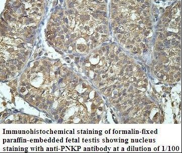 PNKP Antibody