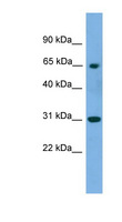PNKP Antibody - PNKP antibody Western blot of Transfected 293T cell lysate. This image was taken for the unconjugated form of this product. Other forms have not been tested.