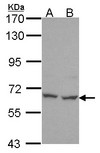 PNKP Antibody - Sample (30 ug of whole cell lysate). A: Hela. B: Hep G2. 7.5% SDS PAGE. PNK antibody. PNKP antibody diluted at 1:1000. 
