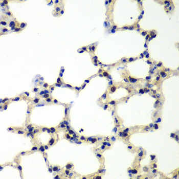 PNKP Antibody - Immunohistochemistry of paraffin-embedded rat lung tissue.