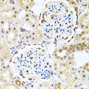 PNKP Antibody - Immunohistochemistry of paraffin-embedded rat kidney tissue.