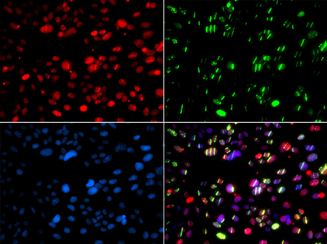 PNKP Antibody - Immunofluorescence analysis of GFP-RNF168 transgenic U2OS cells.