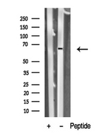 PNKP Antibody - Western blot analysis of PNKP in lysates of Jurkat cells using PNKP antibody.