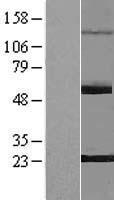 PNLDC1 Protein - Western validation with an anti-DDK antibody * L: Control HEK293 lysate R: Over-expression lysate