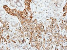 PNLIP / PL / Pancreatic Lipase Antibody - IHC of paraffin-embedded SCM-1 xenograft using Pancreatic Lipase antibody at 1:500 dilution.