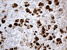 PNLIP / PL / Pancreatic Lipase Antibody - Immunohistochemical staining of paraffin-embedded Human pancreas tissue within the normal limits using anti-PNLIP mouse monoclonal antibody. (Heat-induced epitope retrieval by 1mM EDTA in 10mM Tris buffer. (pH8.5) at 120°C for 3 min. (1:500)
