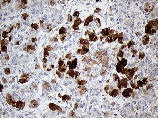 PNLIP / PL / Pancreatic Lipase Antibody - Immunohistochemical staining of paraffin-embedded Human pancreas tissue within the normal limits using anti-PNLIP mouse monoclonal antibody. (Heat-induced epitope retrieval by 1mM EDTA in 10mM Tris buffer. (pH8.5) at 120°C for 3 min. (1:1000)