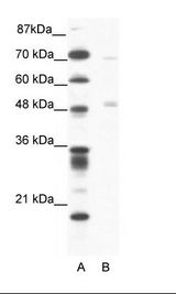 PNLIP / PL / Pancreatic Lipase Antibody - A: Marker, B: Jurkat Cell Lysate.  This image was taken for the unconjugated form of this product. Other forms have not been tested.